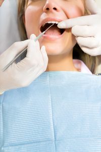 dental implant fresno
