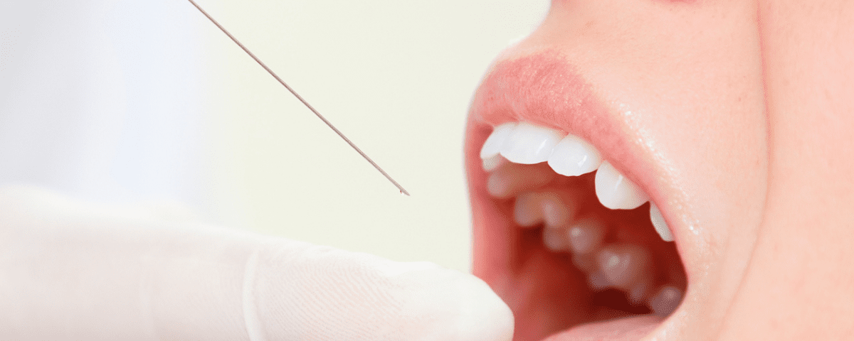 What is Gum Rejuvenation