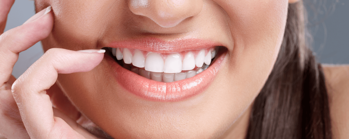 Are Veneers Bad for Your Teeth