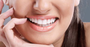 Are Veneers Bad for Your Teeth