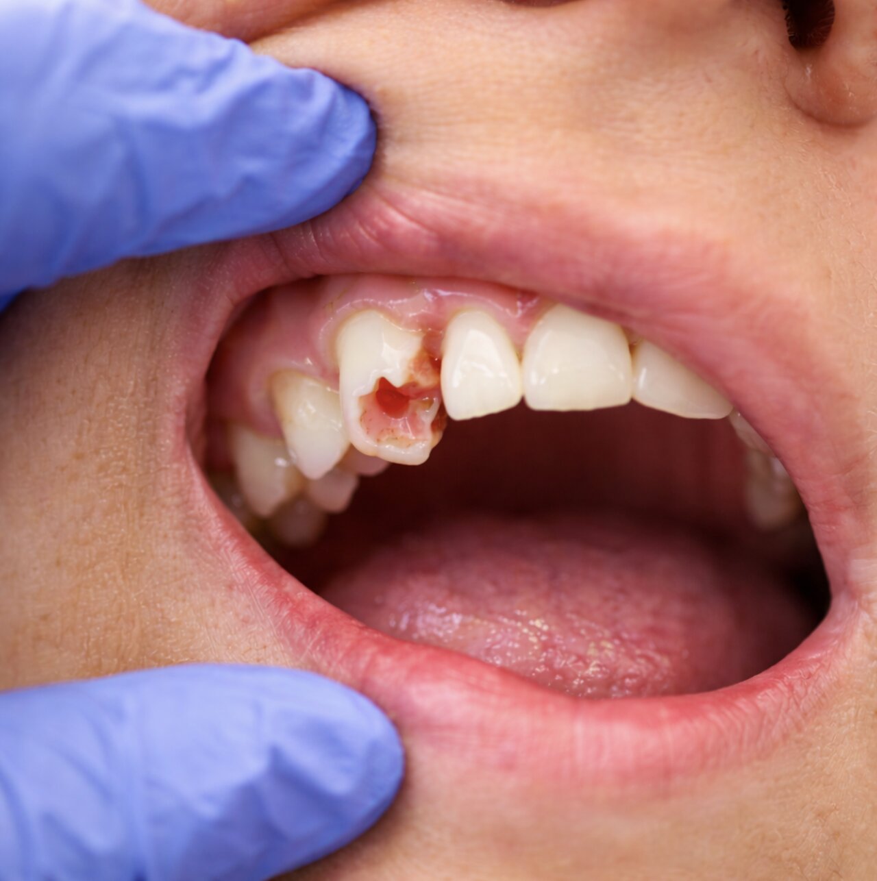 Urgent Dental Care Clovis CA Urgent Dental Care Clovis CA