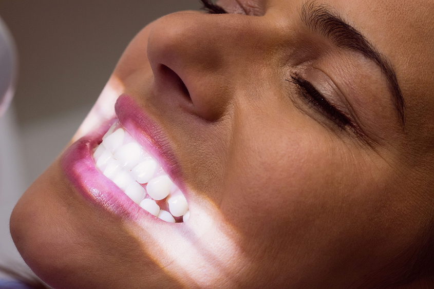 Cosmetic Dentist Clovis - Teeth Whitening 1