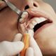 Dentist removing tartar from a patient's teeth with a scaler and dental mirror