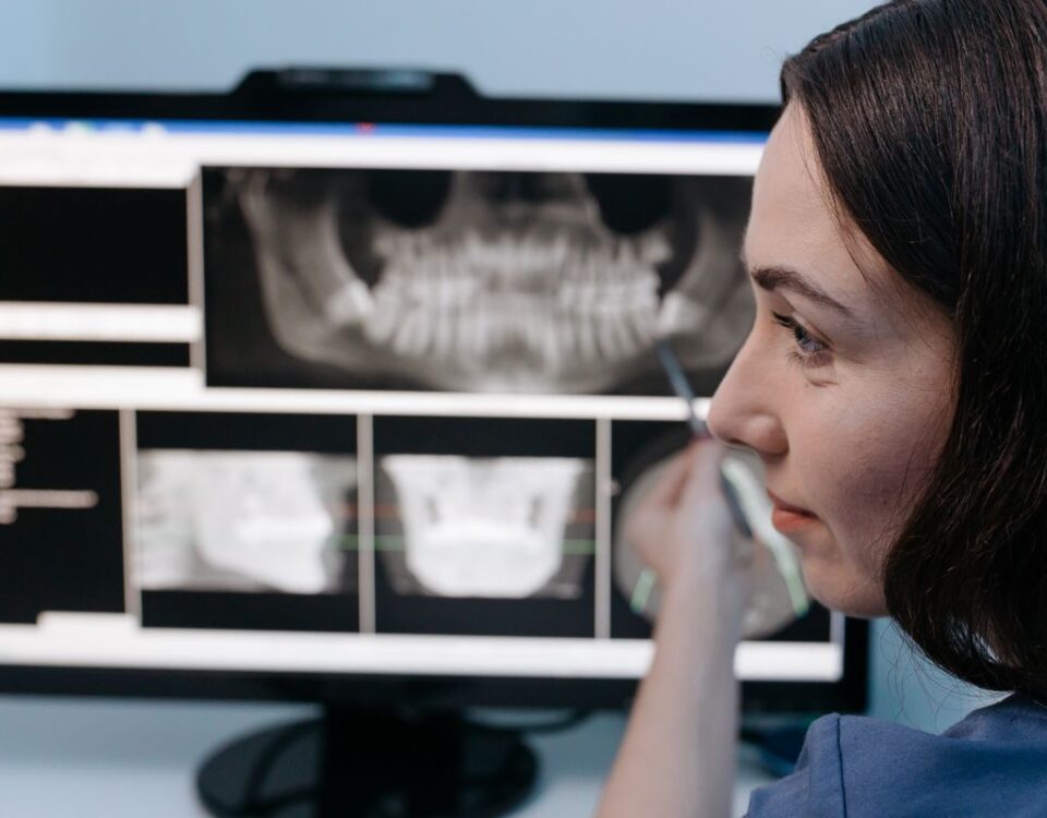 Dentist reviewing digital dental x-rays on a screen