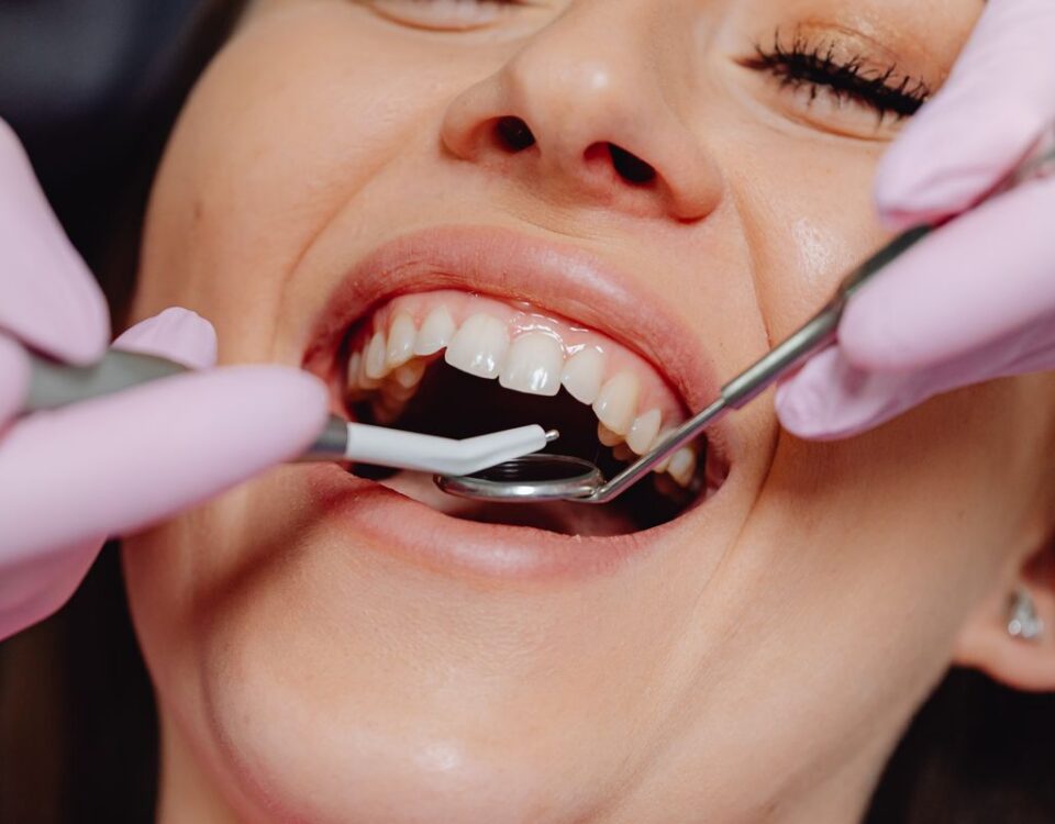 Close-up dental examination of teeth and gums with mirror and probe