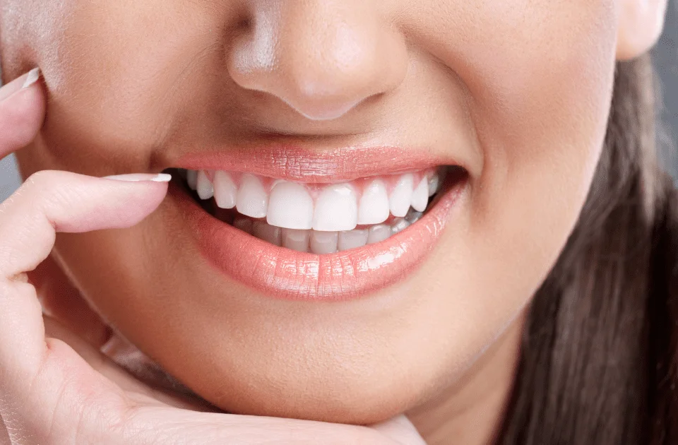 Are Veneers Bad for Your Teeth